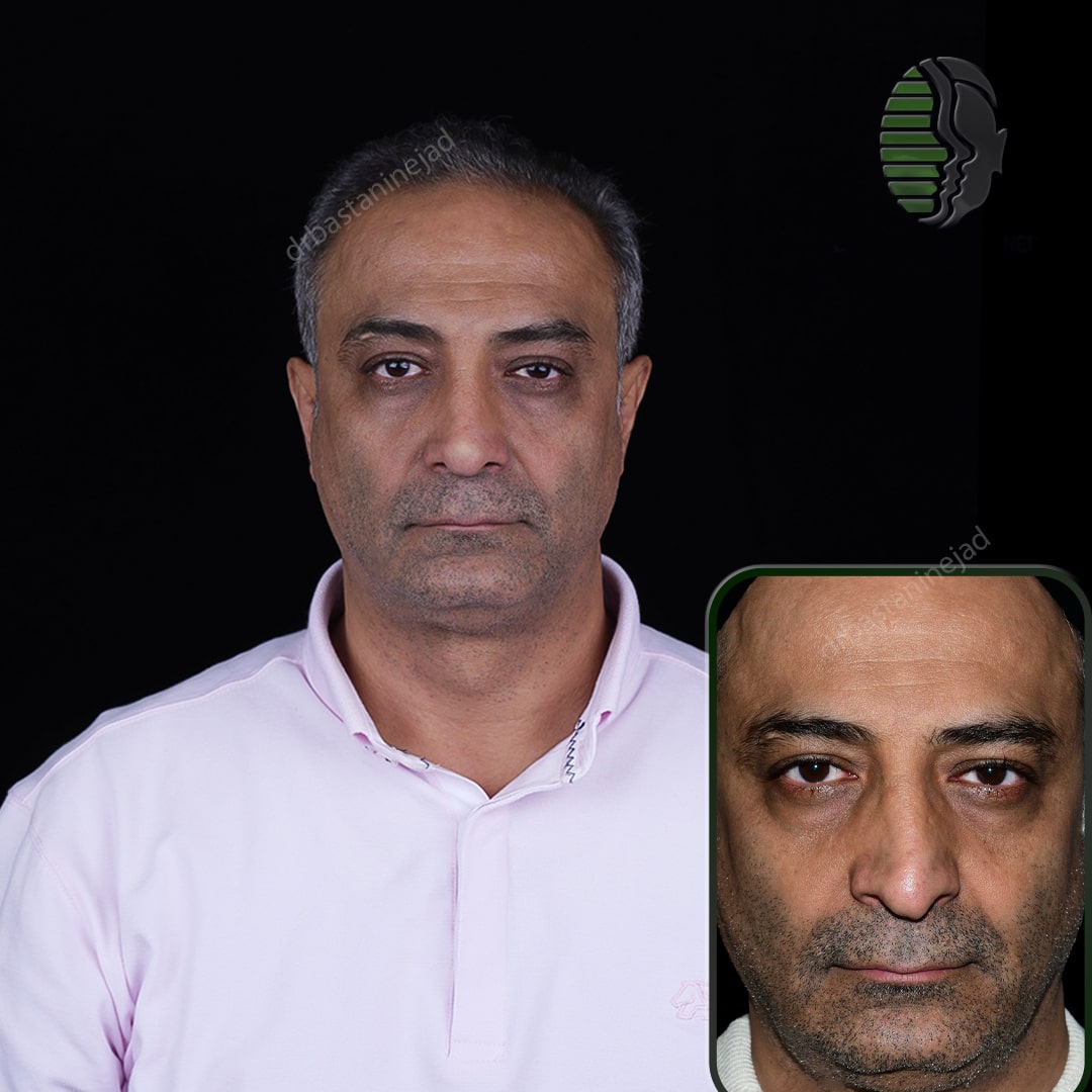 علیرضا ذولقدر_ماه8_رو به رو-min