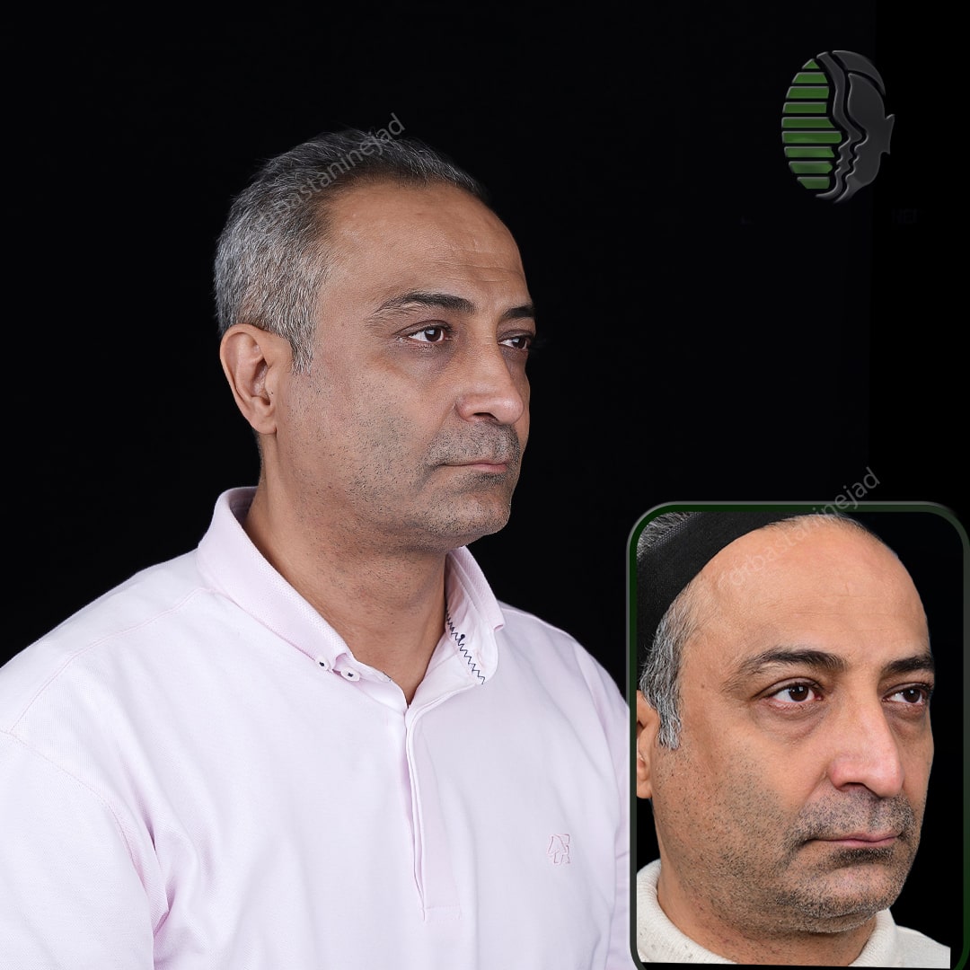 علیرضا ذولقدر_ماه8_سه رخ1-min