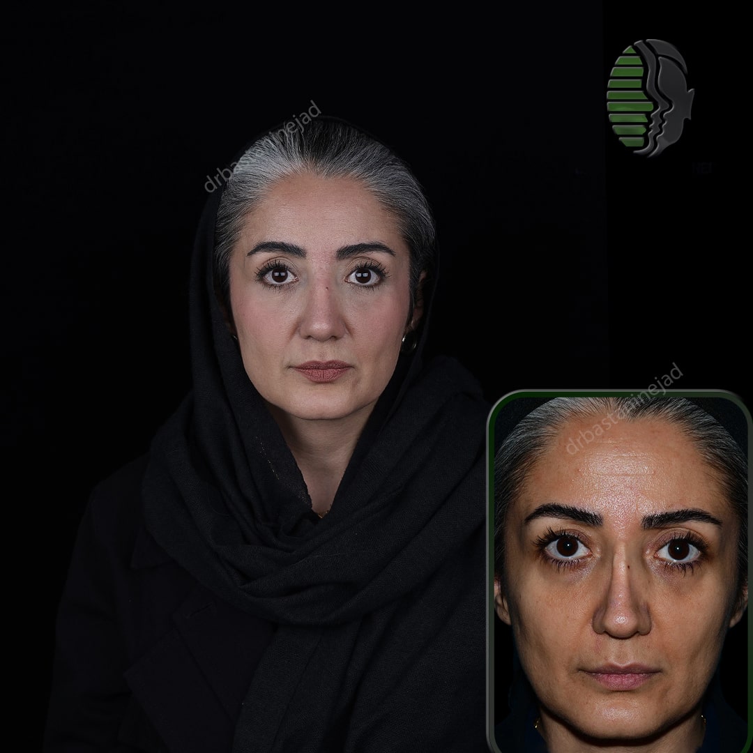 مریم حیدری_رو به رو_ماه4_ترمیم-min