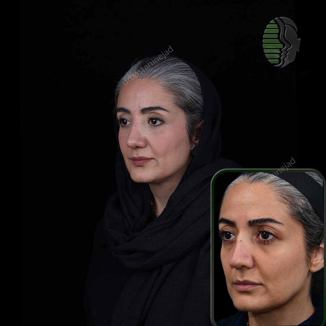 مریم حیدری_سه رخ2_ماه4_ترمیم-min