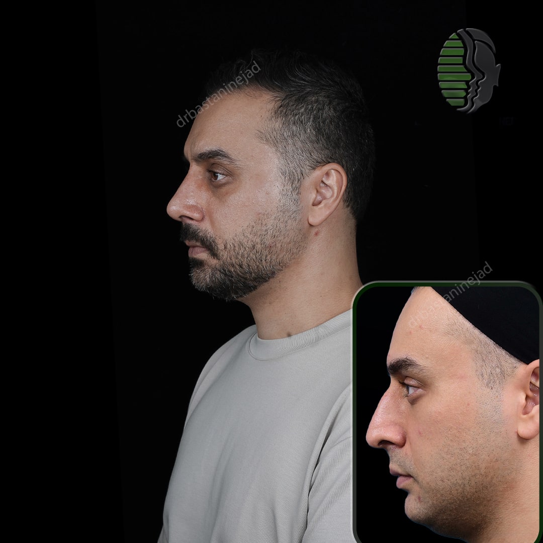 آرین پدرام _نیم رخ2_ماه1-min