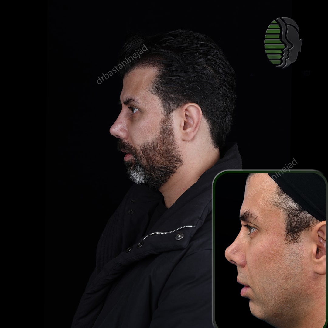 امیر صادقی_نیم رخ2_ماه1-min