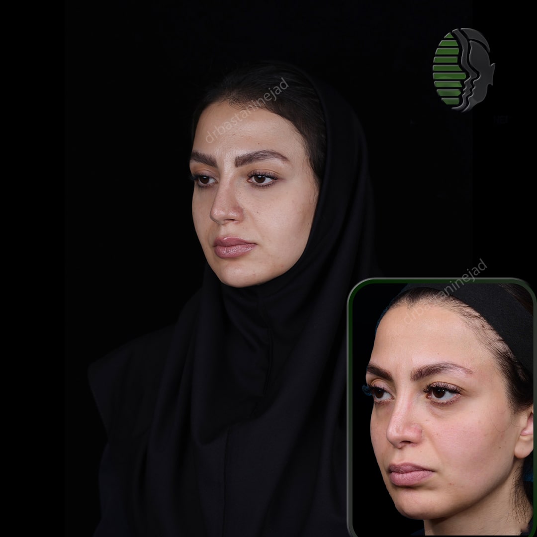 سارا مفیدی_ماه4_سه رخ2_ترمیم-min