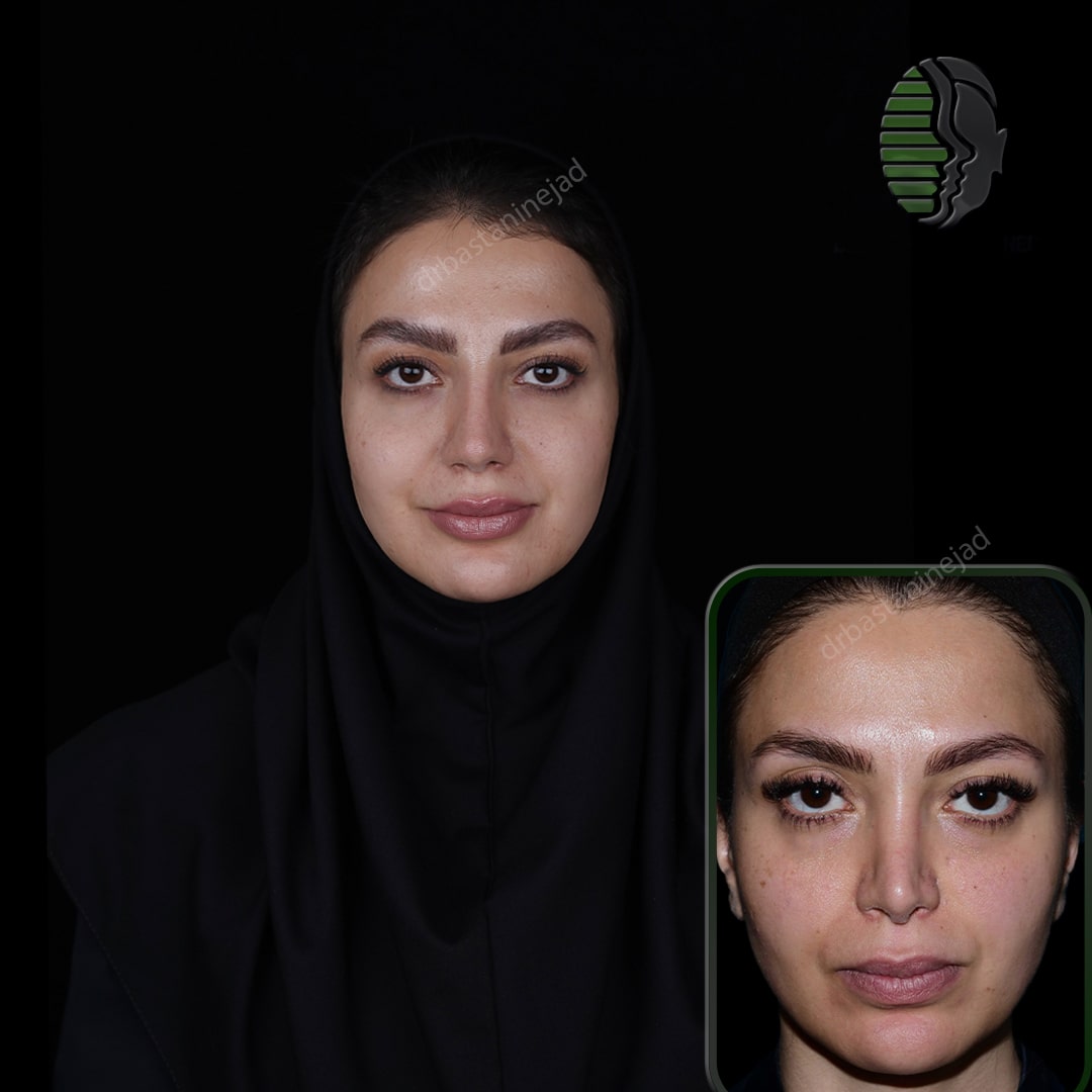 سارا مقیدی ماه4(رو به رو_ترمیم-min (1)