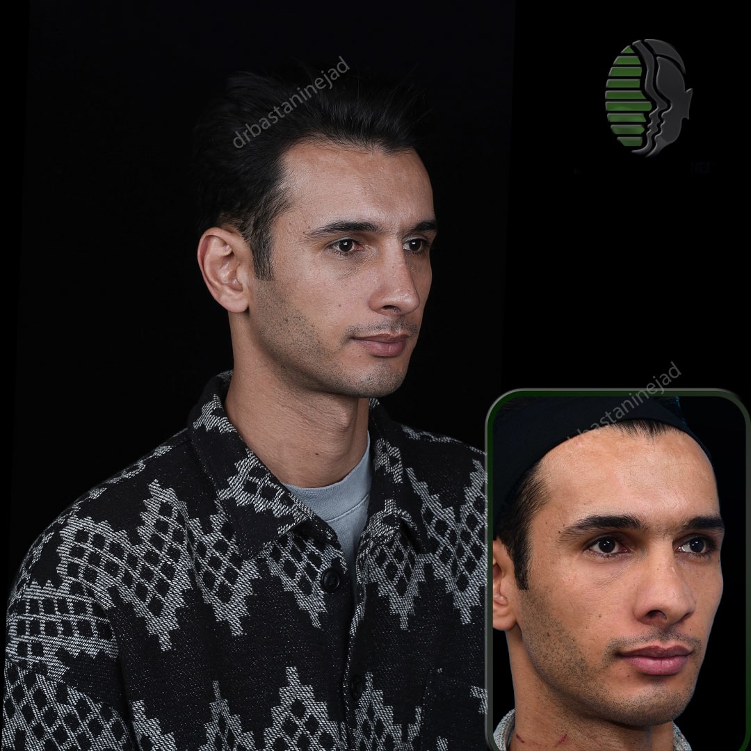 علیرضا محمدی سه رخ1_ماه3-min