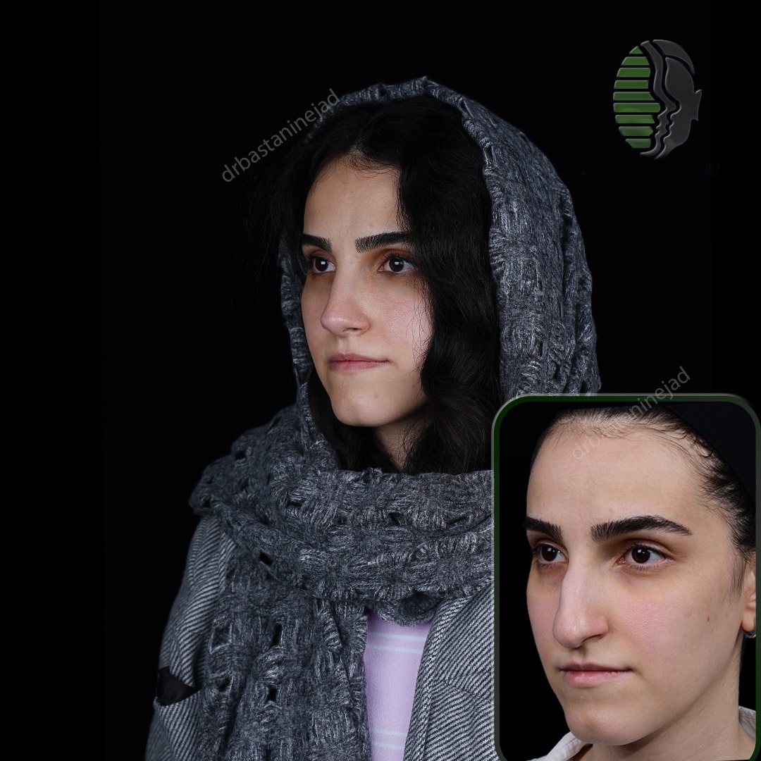 مهرناز عفوری__ماه3_سه رخ2-min