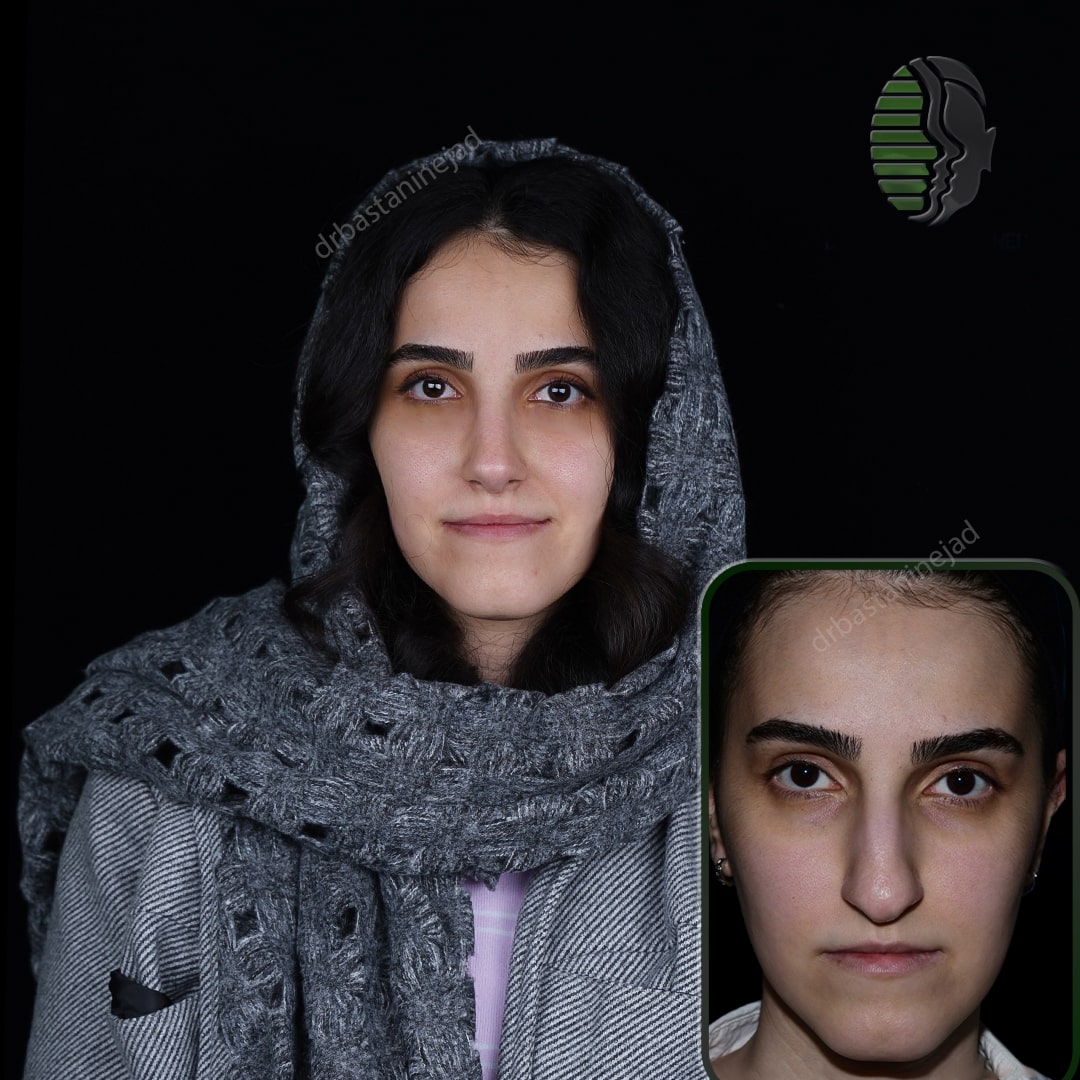 مهرناز عفوری_تمام رخ_ماه3_رو به رو-min