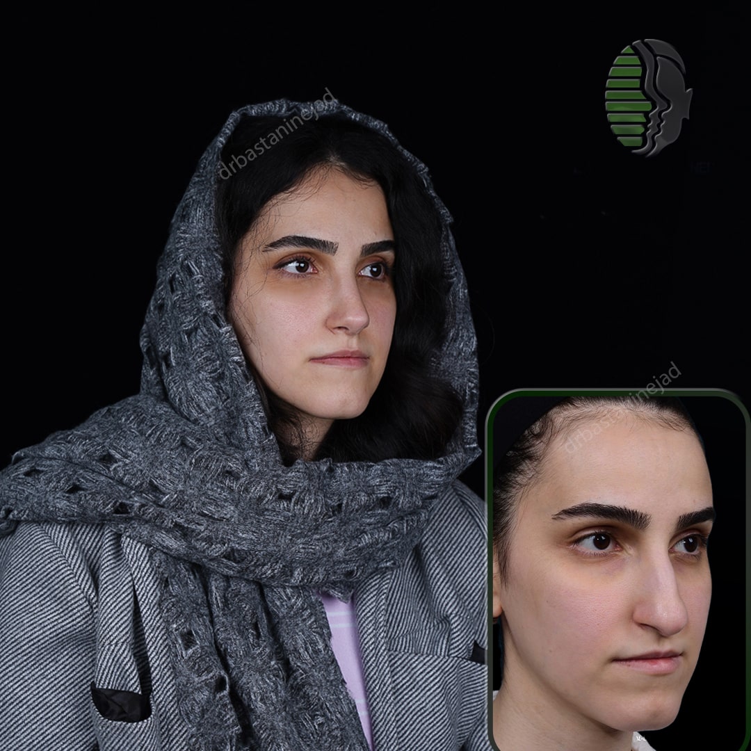 مهرناز عفوری_تمام رخ_ماه3_سه رخ 1-min