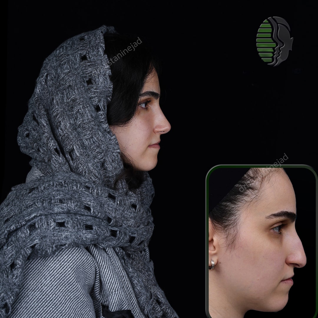 مهرناز غفوری_نیم رخ1_ماه3-min