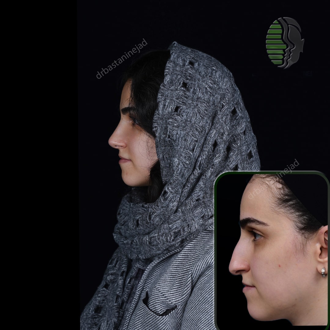 مهرناز غفوری_نیم رخ2_ماه3-min