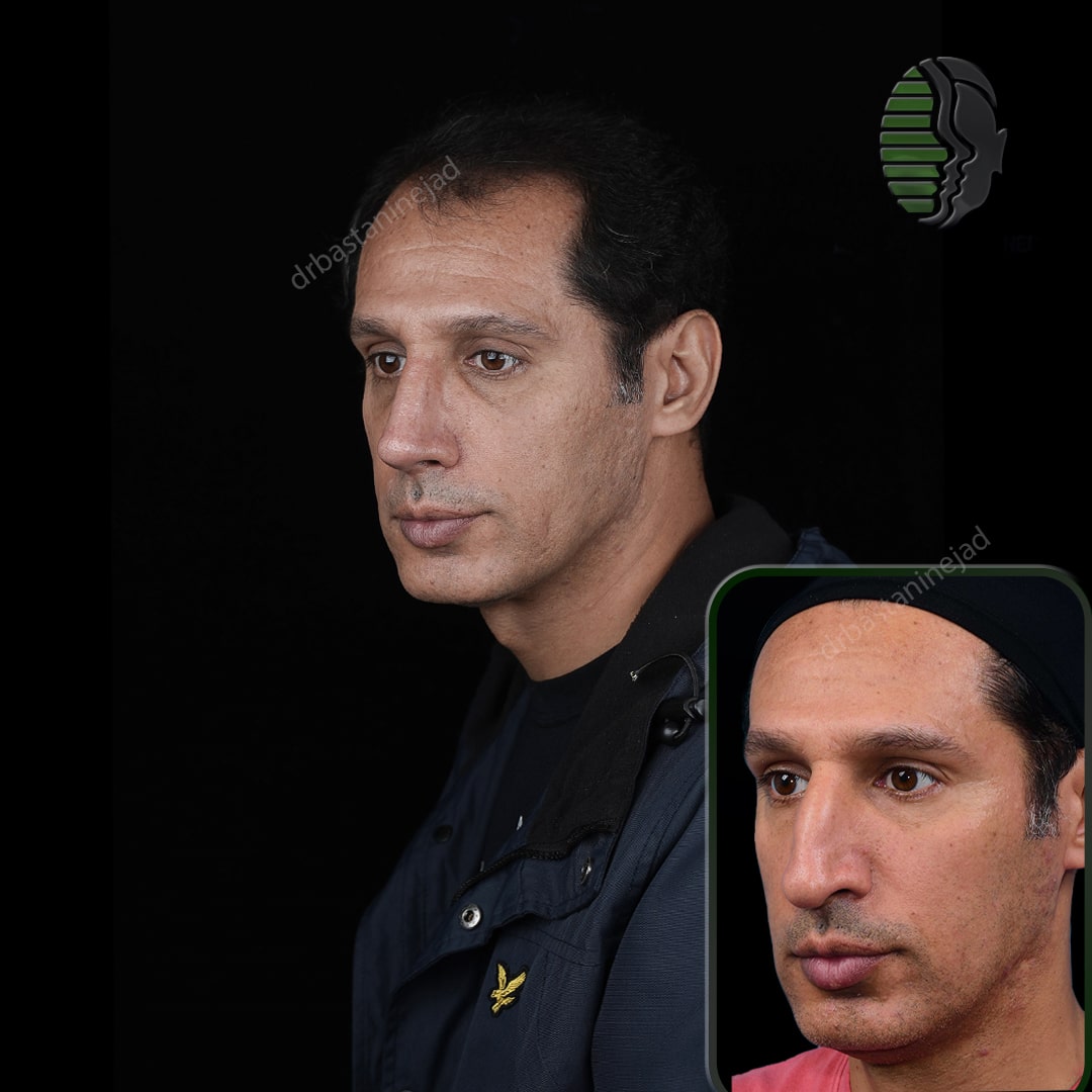 میثم رضایی_سه رخ2_ماه1-min