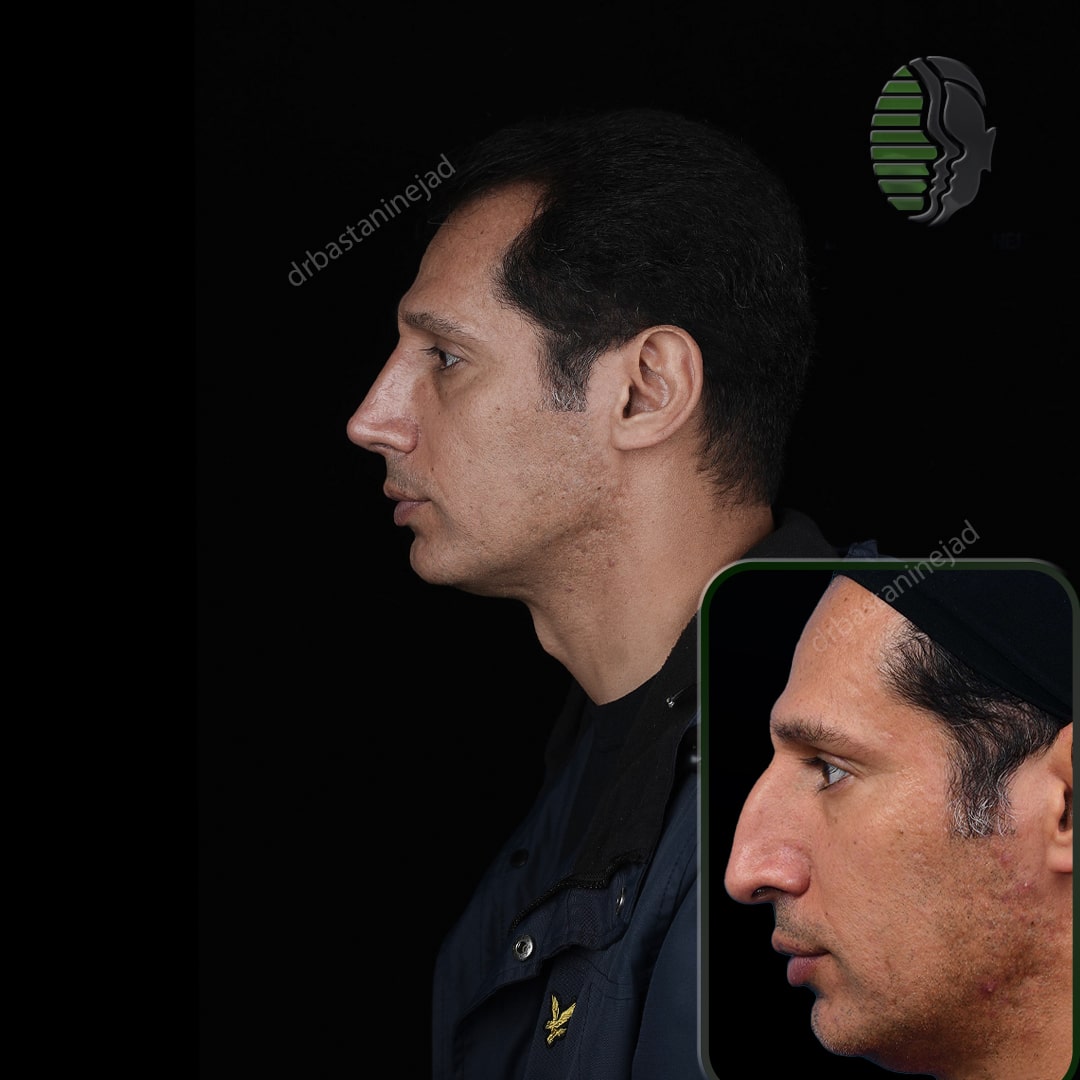 میثم_رضایی_ماه1_اولیه_1404_9_25_نیم_رخ2-min