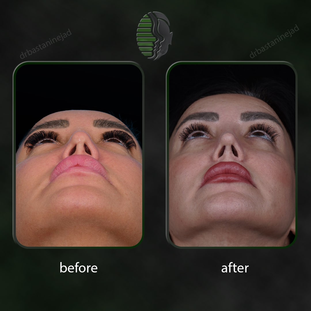 پری سفیداری+قاغده_ماه8-min