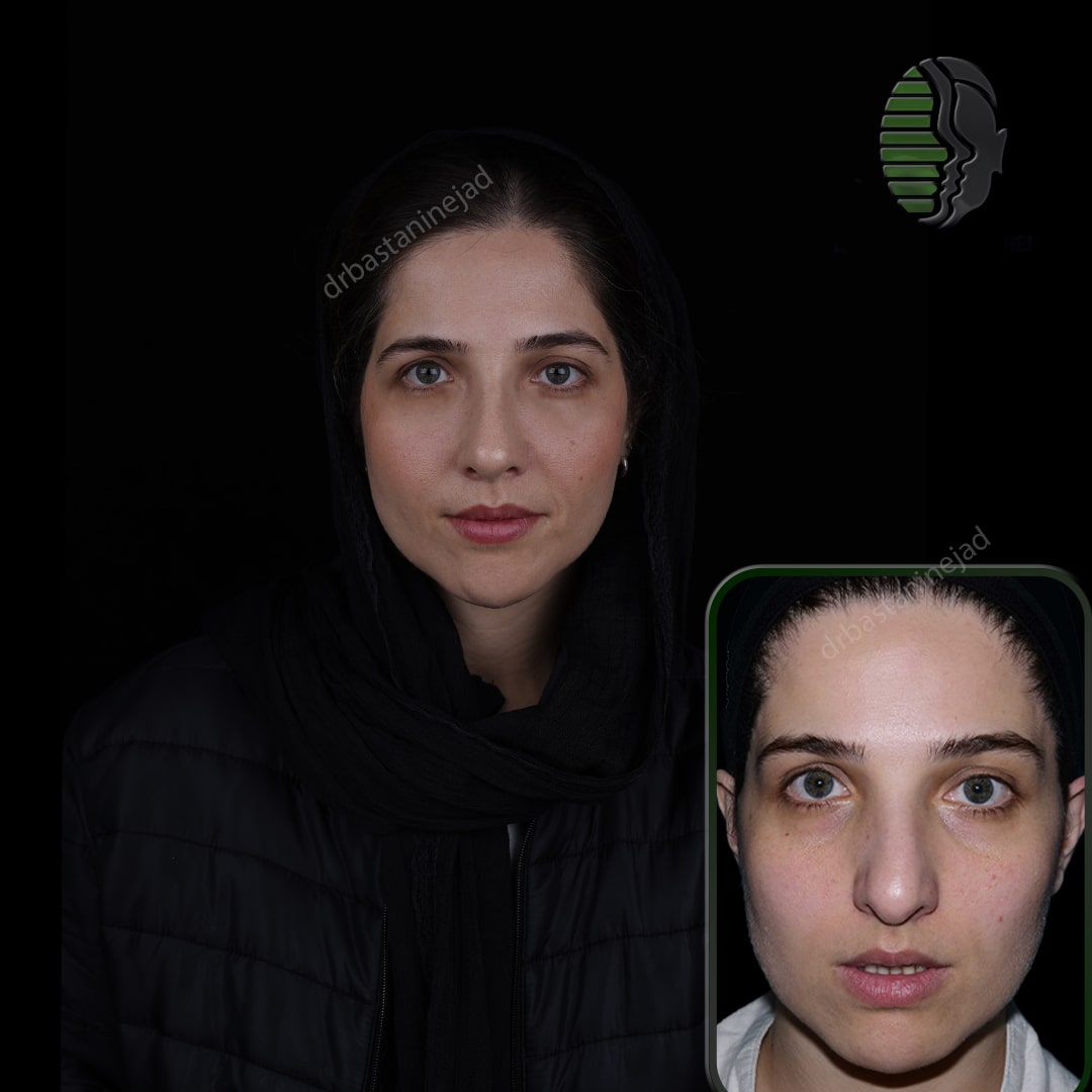 پیمانه نبوی_رو به رو_ماه3-min