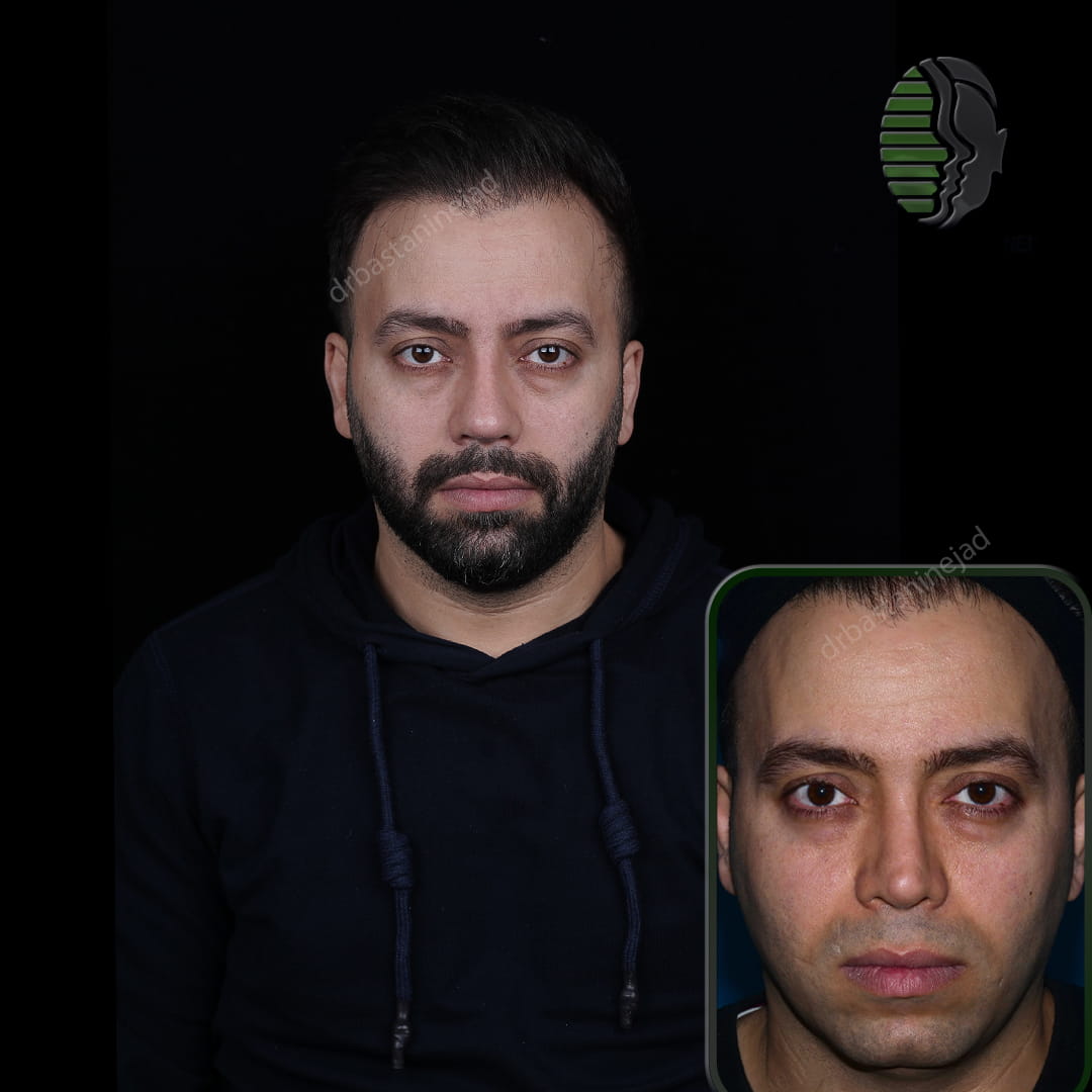 حمیدرضا ابراهیمی_رو به رو_ماه1 (1) (1)