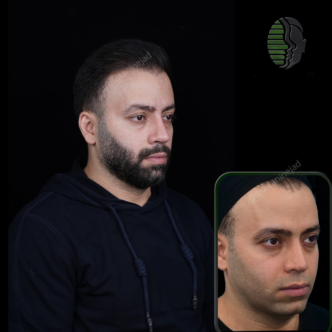 حمیدرضا ابراهیمی_سه رخ1_ماه1 (1) (1)