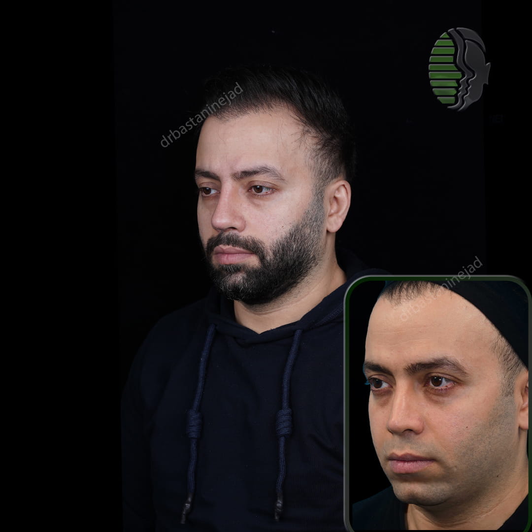 حمیدرضا ابراهیمی_سه رخ2_ماه1 (1) (1)
